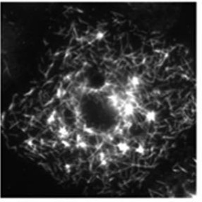 Manuscript illustration: A multicomponent assembly pathway contributes to the formation of acentrosomal microtubule arrays in interphase Drosophila cells