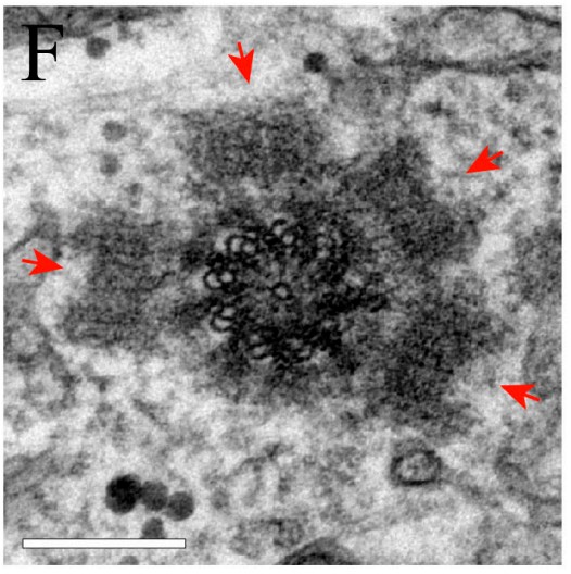 Manuscript illustration: The SCF Slimb ubiquitin ligaseregulates Plk4/Sak levels to block centriole reduplication