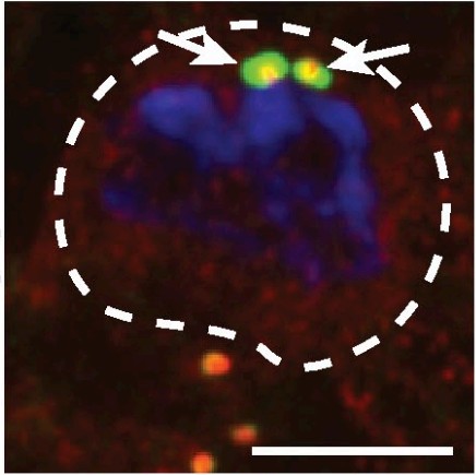 Manuscript illustration: PLP inhibits the activity of interphase centrosomes to ensure their proper segregation in stem cells