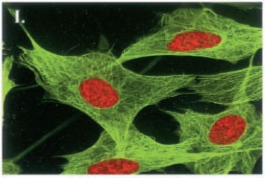 Manuscript illustration: Noscapine alters microtubule dynamics in living cells and inhibits the progression of melanoma