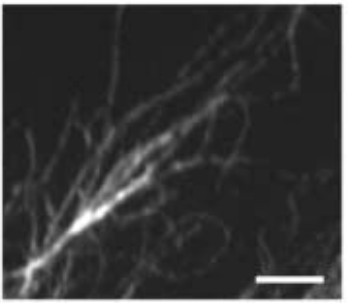 Manuscript illustration: Reorganization of the microtubule array in prophase/prometaphase requires cytoplasmic dynein-dependent microtubule transport