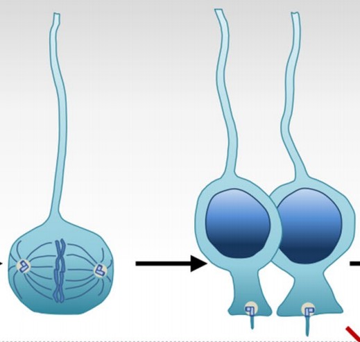 Manuscript illustration: Same but Different - Pleiotropy in Centrosome-Related Microcephaly.