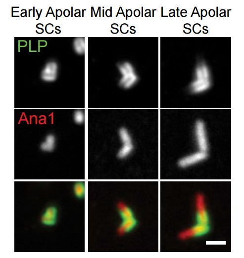 Manuscript illustration: Sperm Head-Tail Linkage Requires Restriction of Pericentriolar Material to the Proximal Centriole End