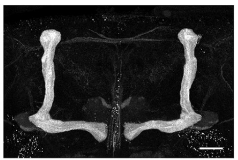 Manuscript illustration: Traip controls mushroom body size by suppressing mitotic defects