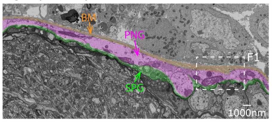 Manuscript illustration: Tumor-Associated Macrophages Promote Brain Metastasis.